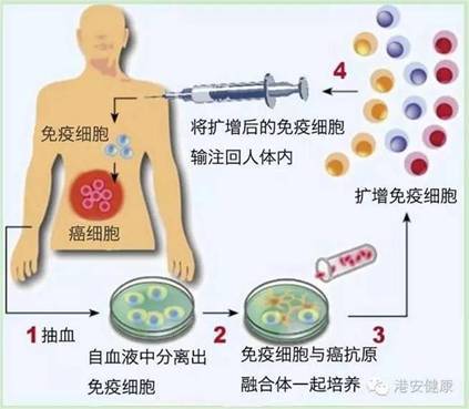台湾细胞免疫疗法-香港港安健康管理