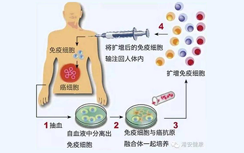 免疫疗法专题