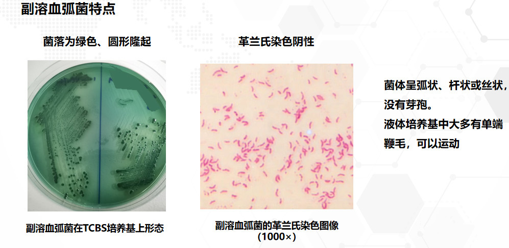 弧菌真的可怕？