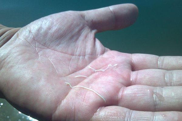 南美白对虾得了白便会有哪些症状？如何防治白便发生？