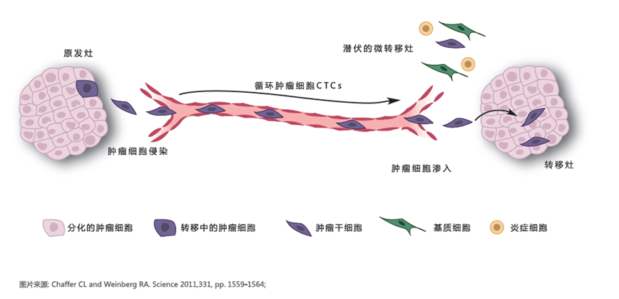 海吉力ACTC将肿瘤病人创伤降到最低