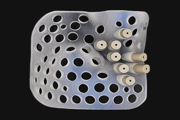 3D打印手術導板讓外科手術更精準