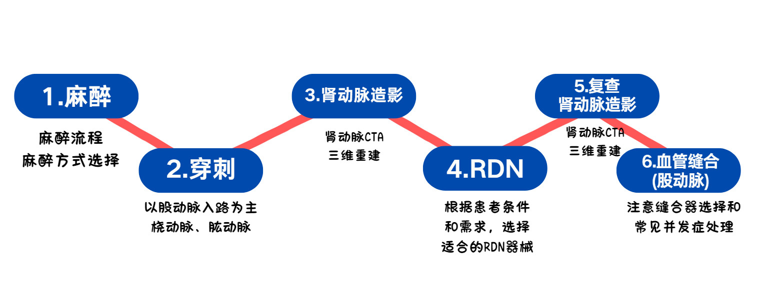 腎動(dòng)脈消融手術(shù)流程