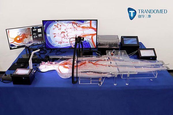 3D打印顱內模型神經介入手術的臨床應用
