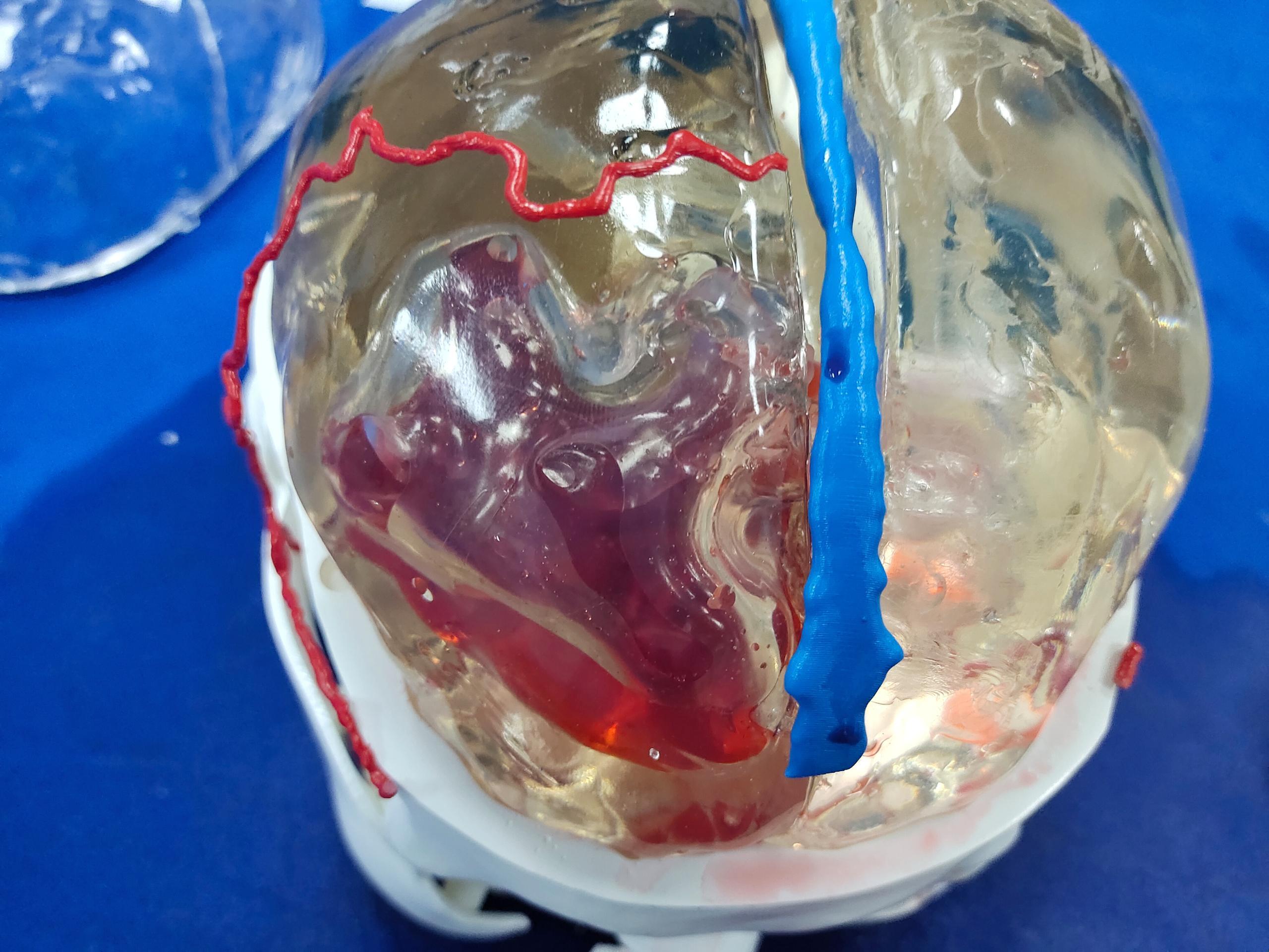 腦出血模型