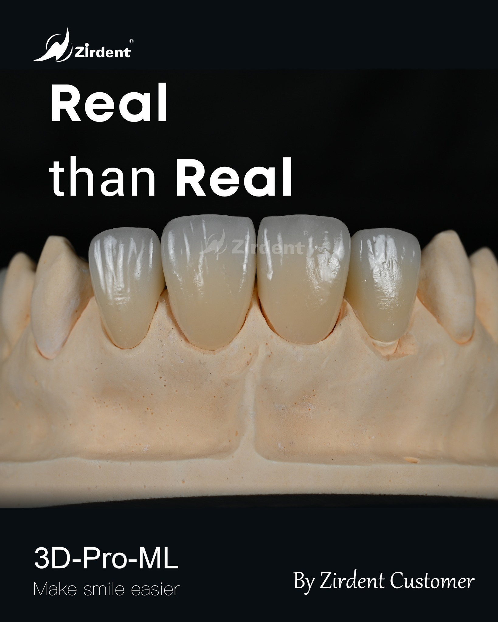Zirdent 3D-Pro-ML  Zirconia Case by Zirdent Customer