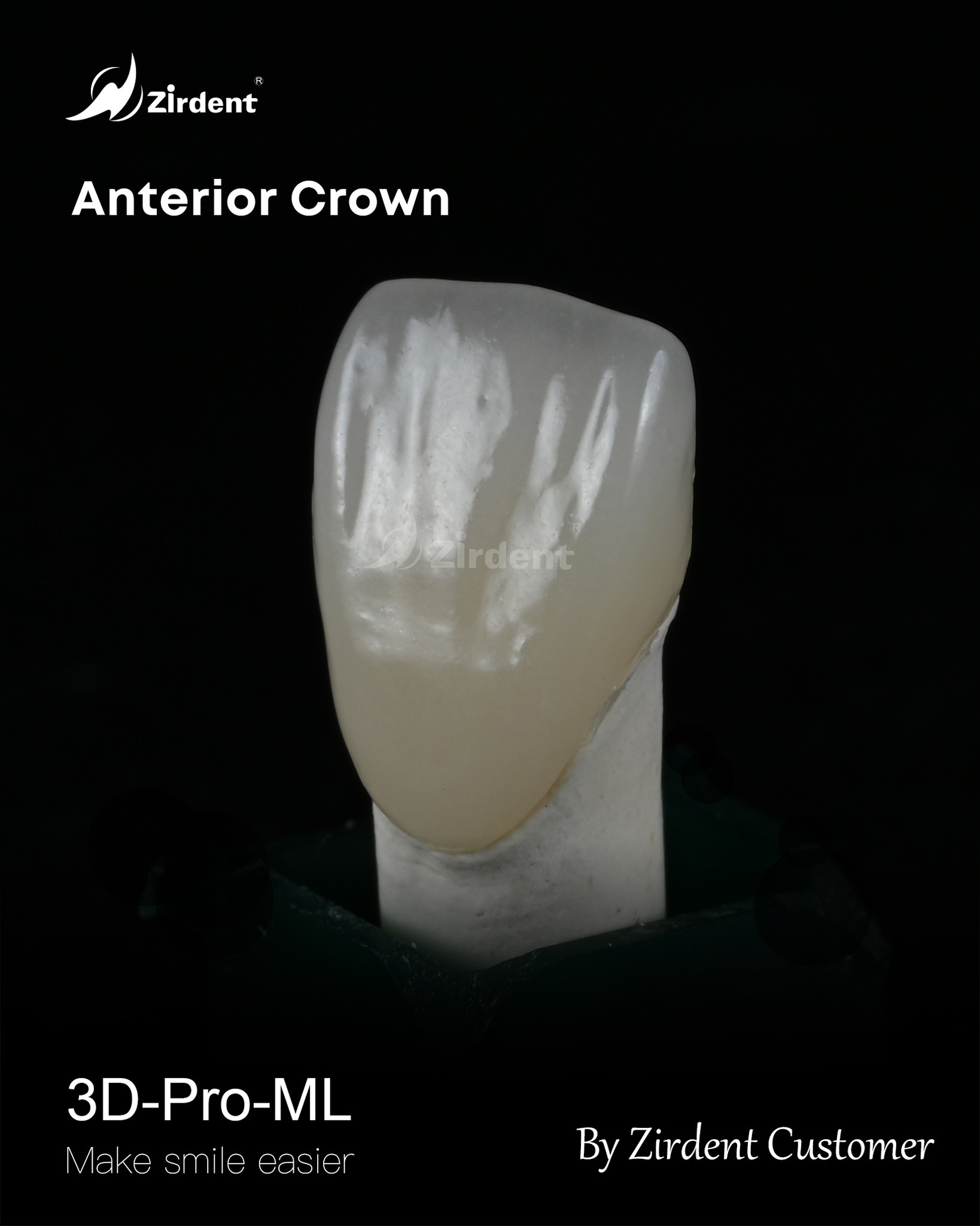 Zirdent 3D-Pro-ML  Zirconia Case by Zirdent Customer