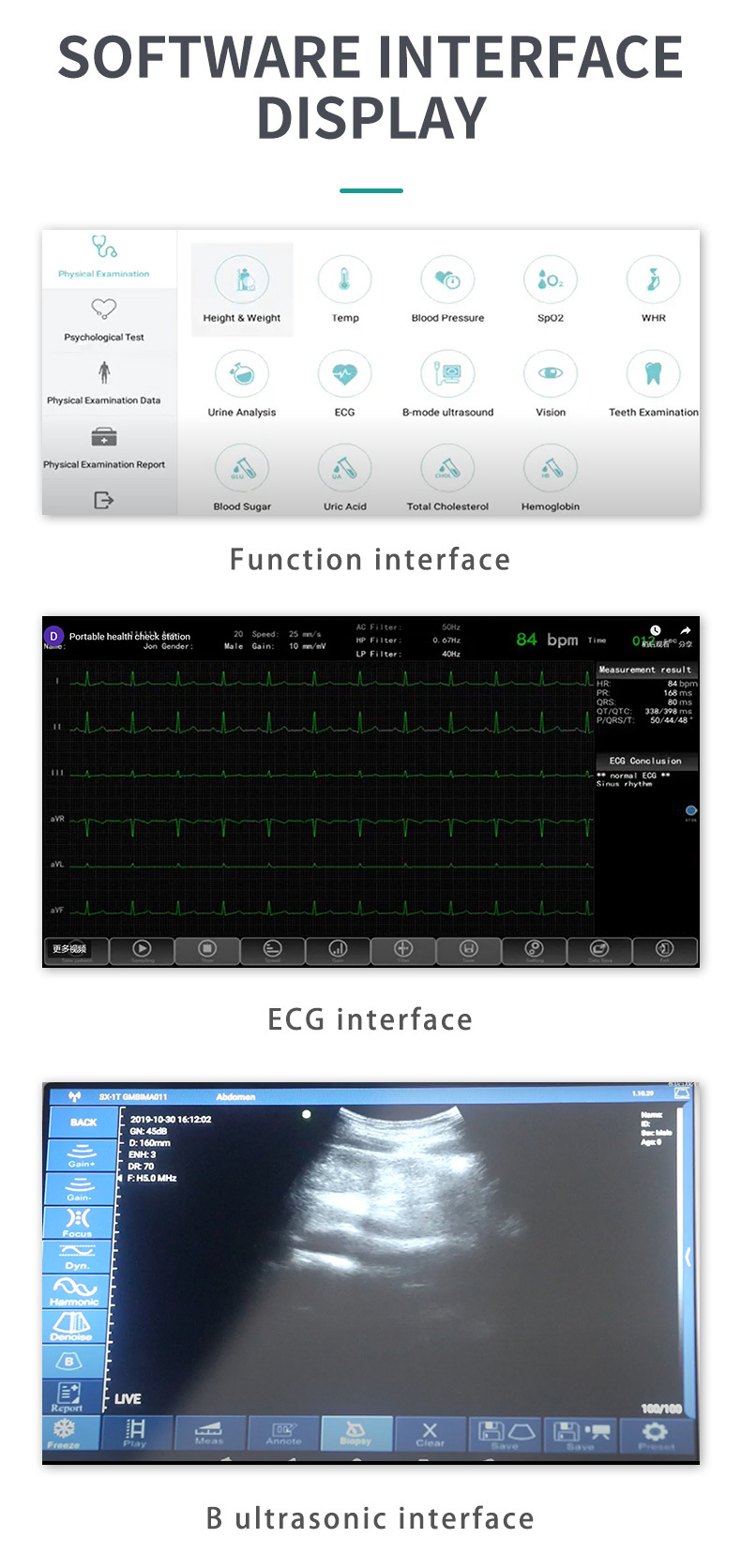 Medical Diagnostic Machine 12-LEAD ECG BL0OD PRESSURE GLUCOSE-Yiwu ...