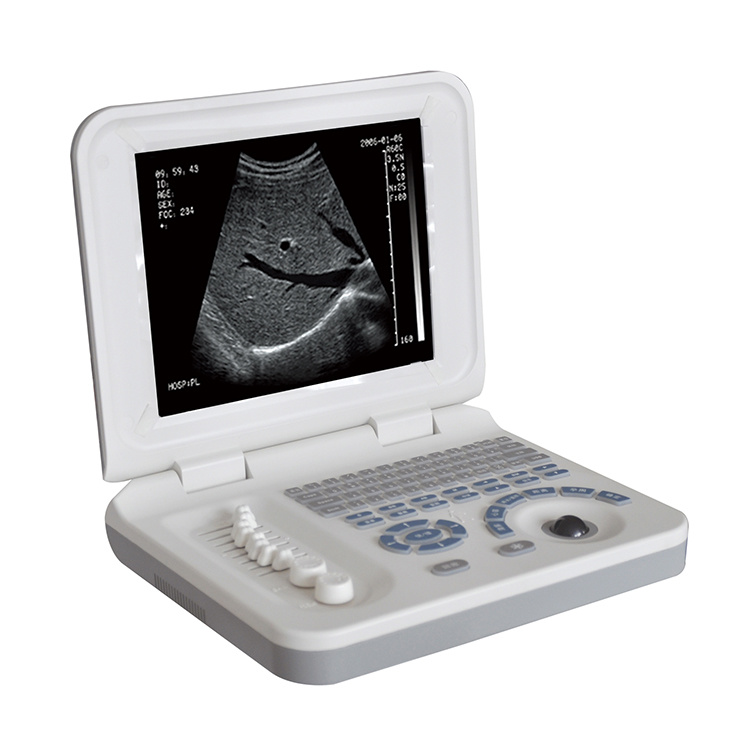 Gynecological pregnancy examination device portable ultrasound scanner