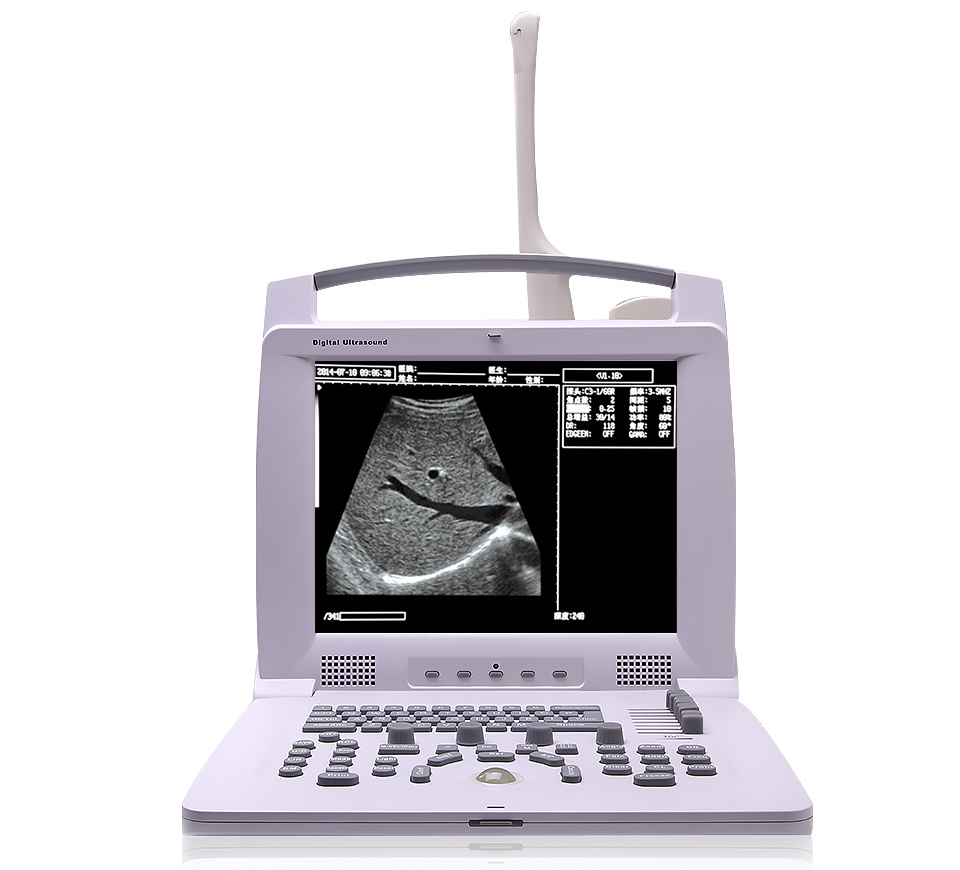 Hospital use good quality medical equipment portable ultrasound doppler machine