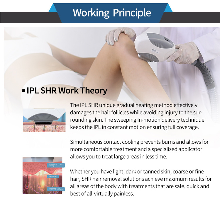 New Released OPT ipl shr laser hair removal Machine Beijing KES