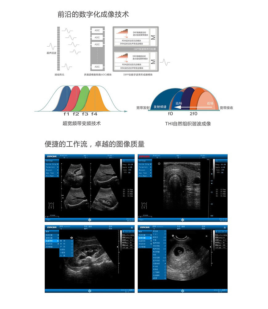 武汉中旗 全数字彩色多普勒超声诊断系统ZONCARE-V5