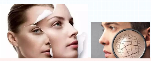 The underlying logic of skin care-one minute to teach you to understand skin quality