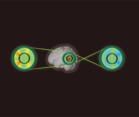采用EEG和fNIRS联合记录，宋艳课题组在《Cerebral Cortex》发文揭示视觉注意的神经血氧耦合机制