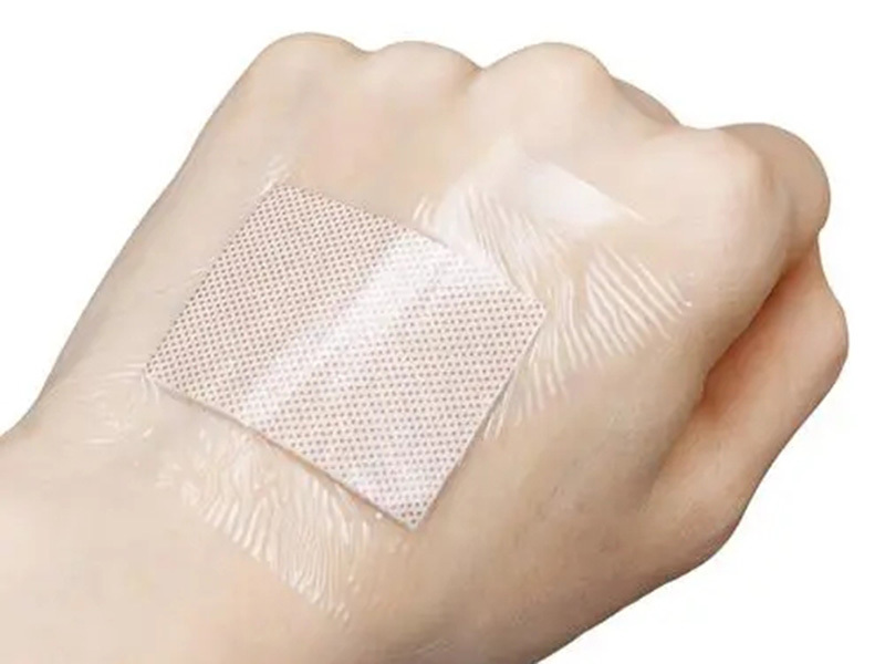 Sticking techniques for common wound dressings