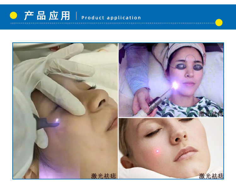 激光美容