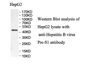 Hepatitis B virus pre-S1 antibody (pAb)