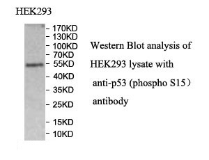 p-P53 (phospho S15) antibody (pAb) p-P53 (phospho S15) antibody (pAb)