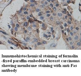 FAS antibody (pAb)