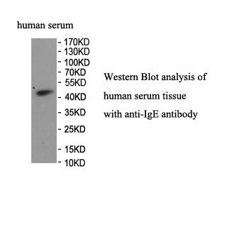 Human IgE antibody（mAb）
