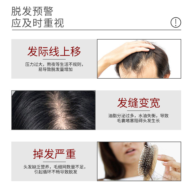 防脫育發(fā)洗發(fā)水樸教授抖音同款生姜洗發(fā)露OEM貼牌定制加工廠家