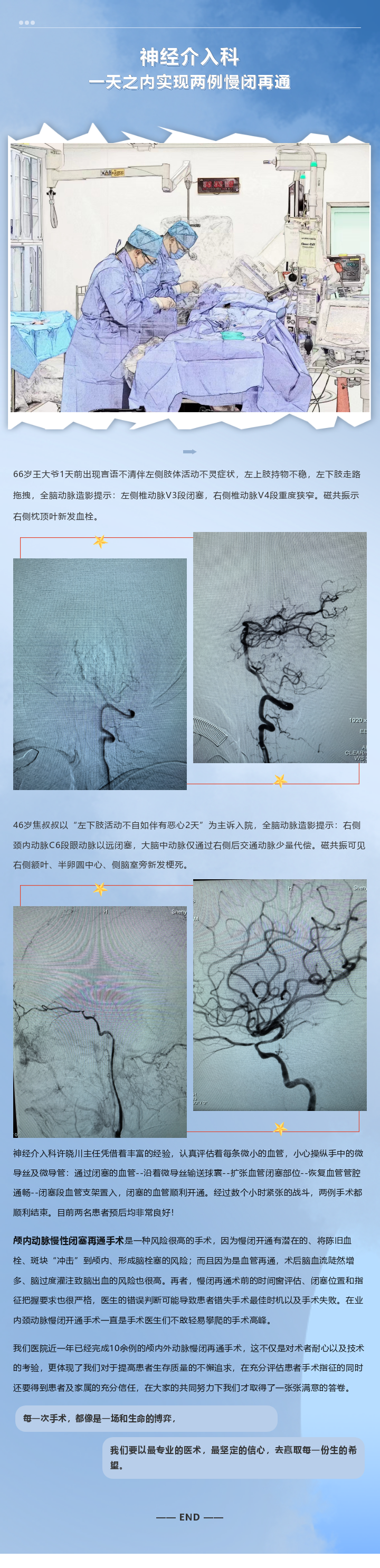 颈内动脉闭塞图片