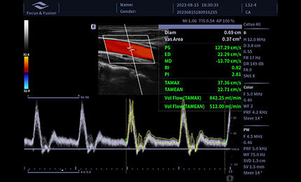 Auto Volume Flow