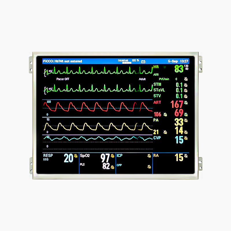 10.4 inch 1024x768 LCD display for patient monitor (HC104IM65065-B24V01)