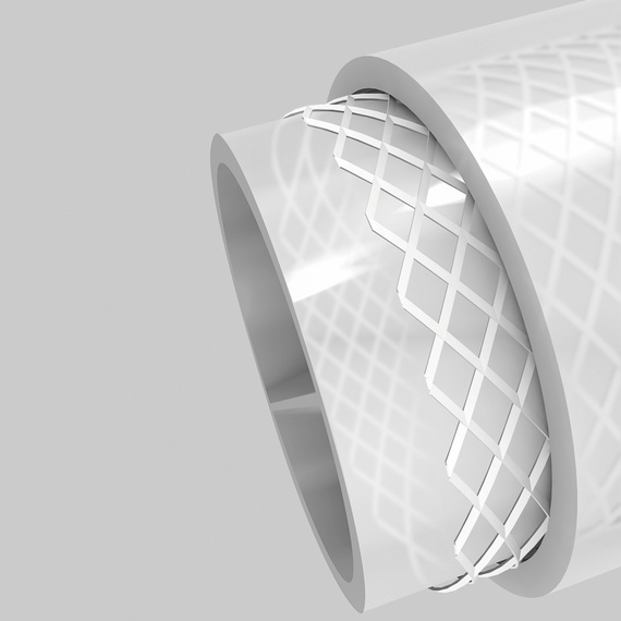 NORFLEX® Construction with fabric reinforcement NORFLEX® Construction with fabric reinforcement