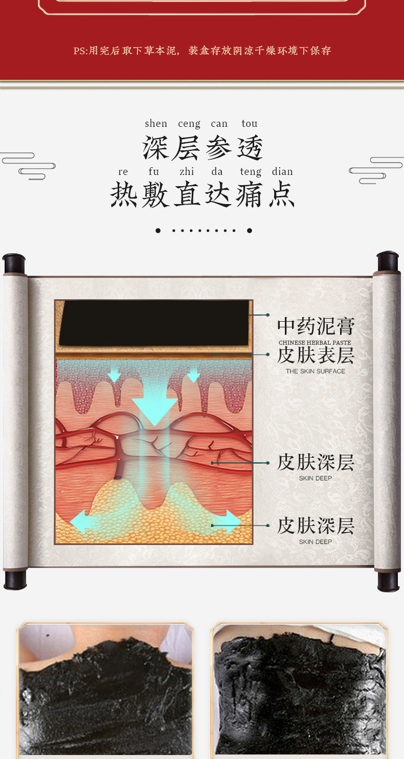 泥灸