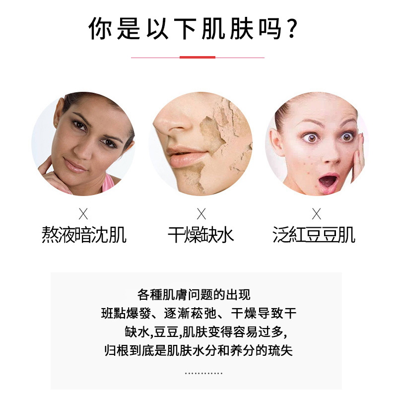 火動力玫瑰面部按摩精油植物萃取改善毛孔淡黑煥白美容院面部護理OEM代加工