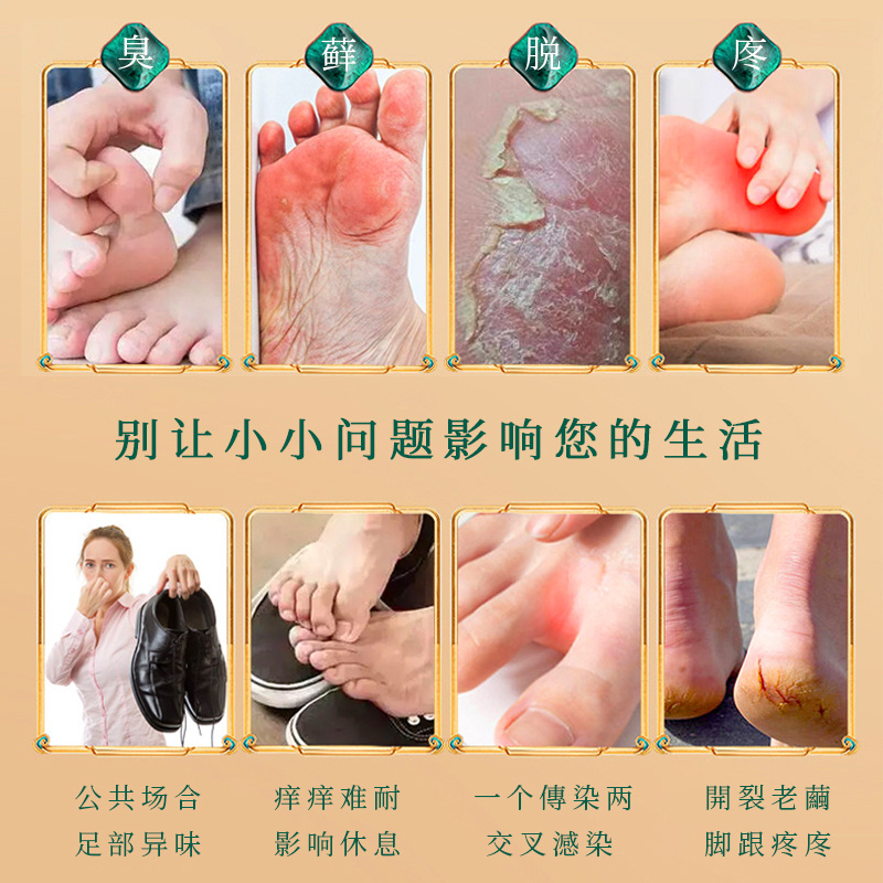 榮足堂紫草噴劑草本精粹深層滲透有效呵護(hù)肌膚溫和舒適現(xiàn)貨