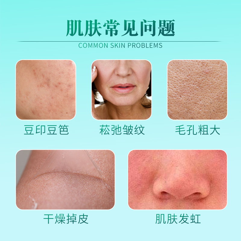 代加工OEM龍膽花靜顏修護(hù)套組溫和不刺激