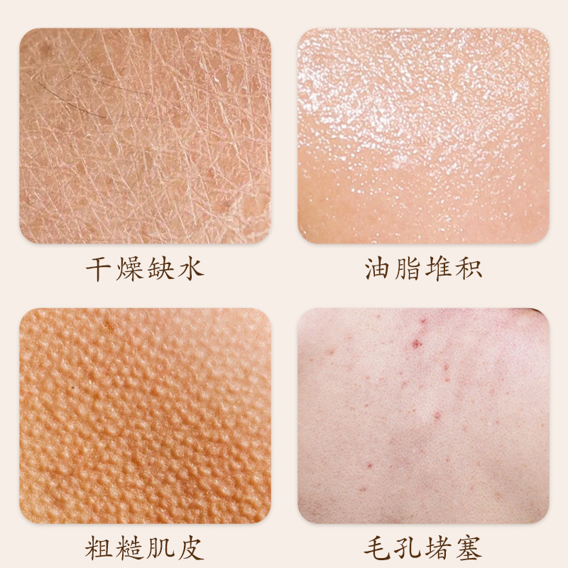 魚子精華緊致提拉護膚品套裝面部護理補水保濕水乳化妝品全套套盒