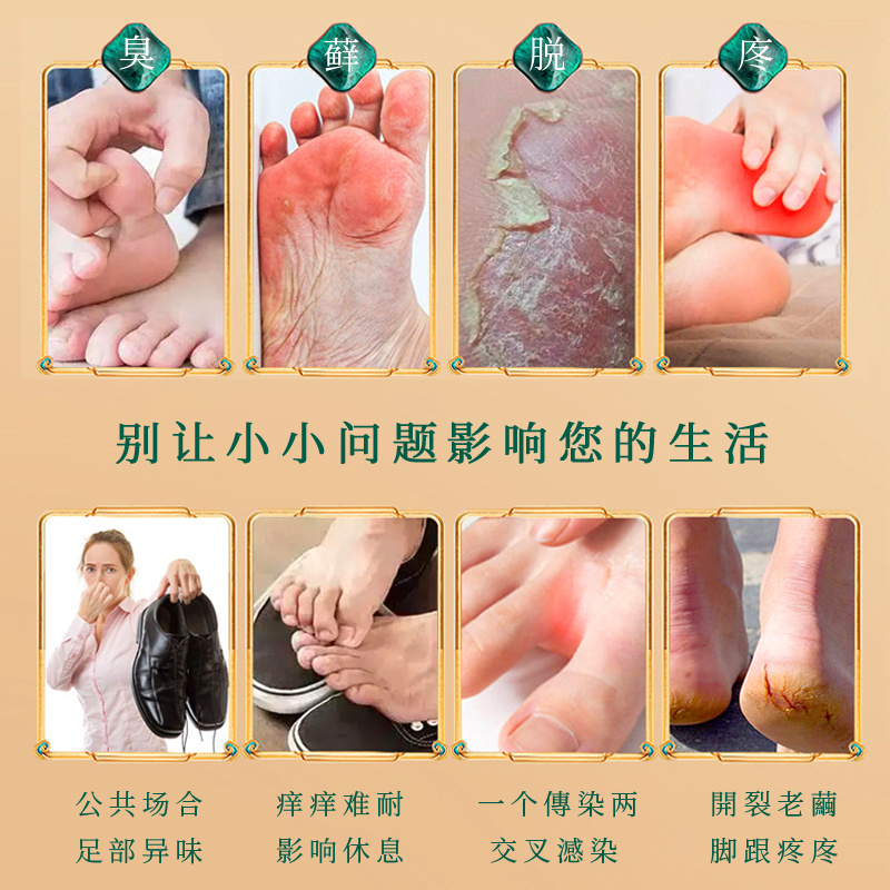 榮足堂紫草噴劑草本精粹深層滲透有效呵護(hù)肌膚溫和舒適現(xiàn)貨