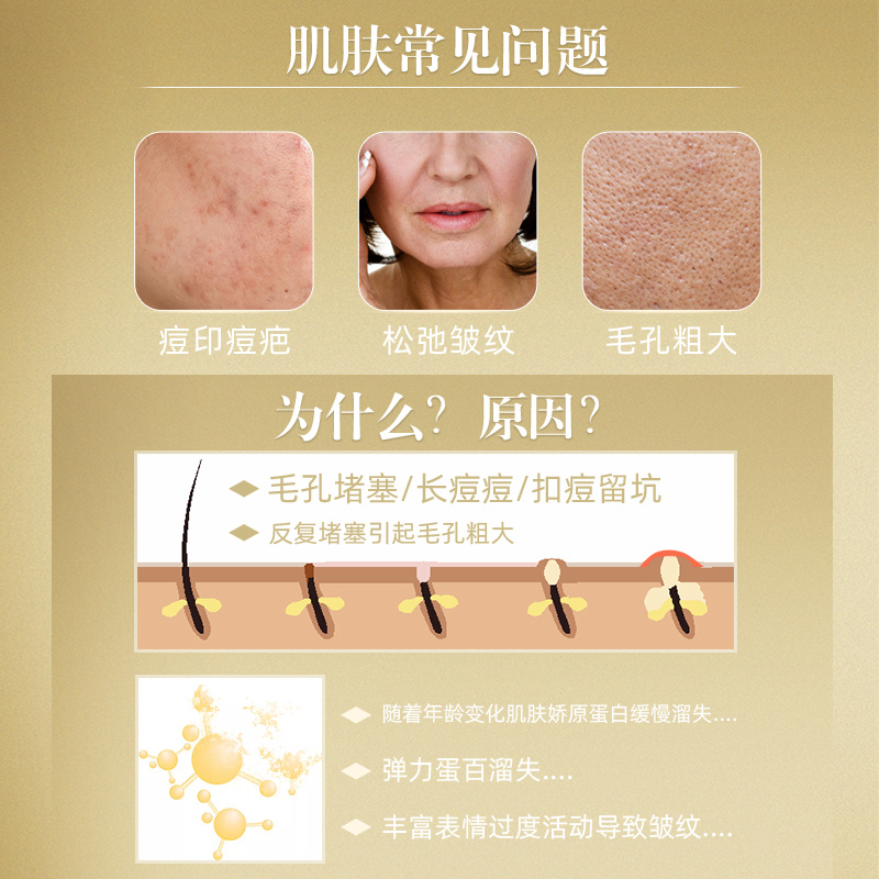 榮奧女王奇肌套改善細紋換貨基地植物萃取無愴透肌淡化細紋防松弛正品現貨