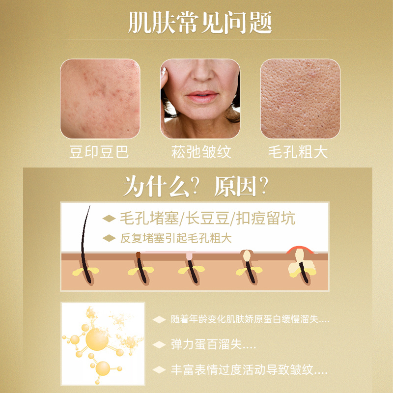 女王奇肌套面部護理改善毛孔粗大淡化細紋護膚套裝