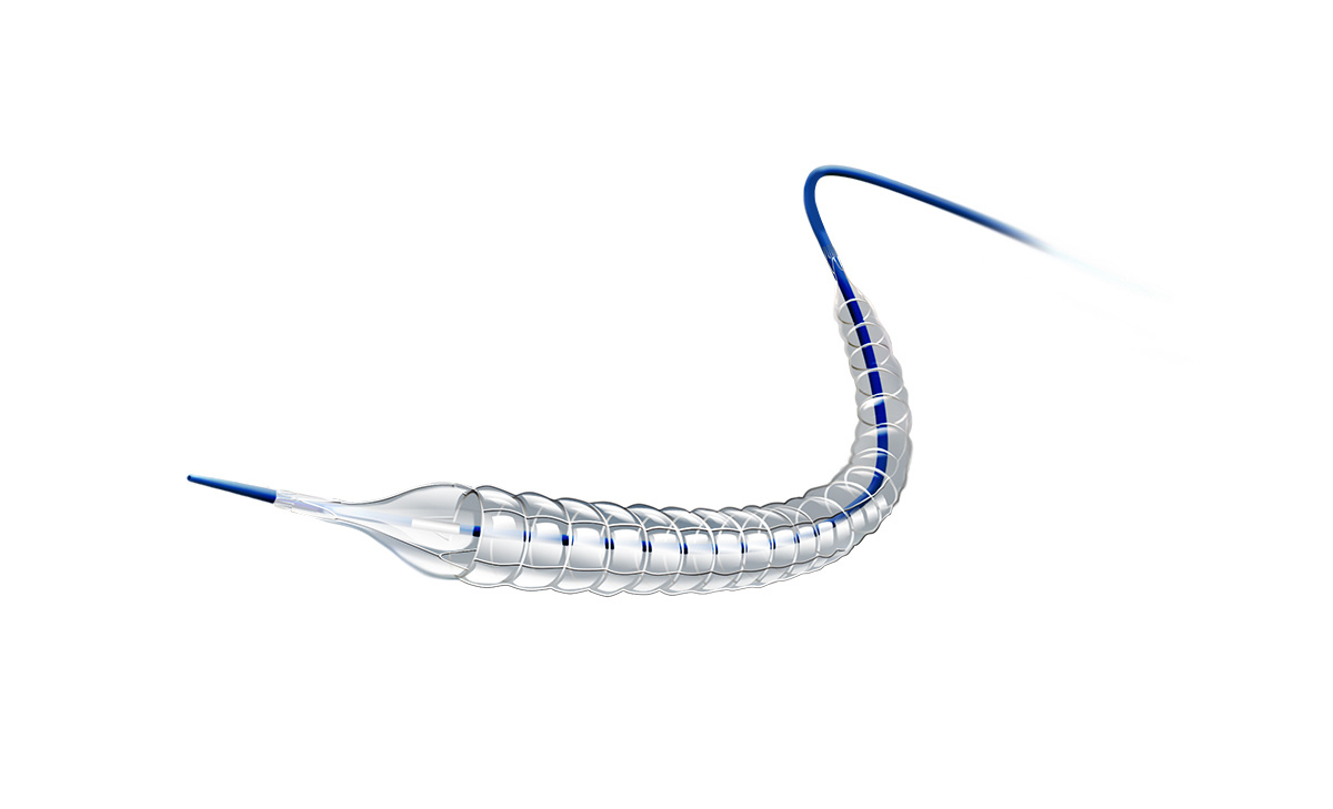 CixPak™腹肌球囊<br>一次性使用约束型外周球囊扩张导管