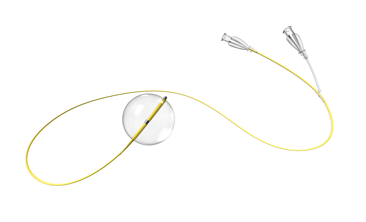 Chess Occlusion Balloon Catheter