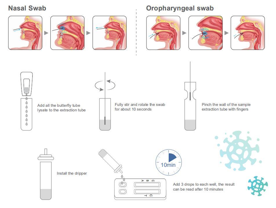 COVID-19/Influenza A+B Antigen Combo Rapid Test Kit (Colloidal gold method)