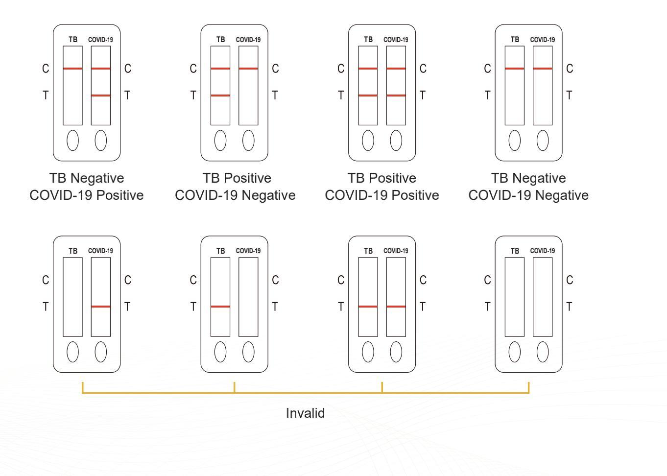 SARS-CoV-2 / Tuberculosis Antigen Combo Rapid Test Kit (Colloidal gold method)