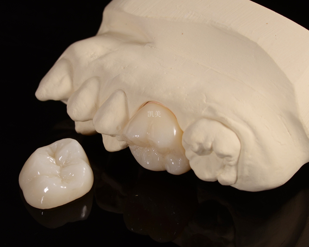 Layered Zirconia Layered Zirconia