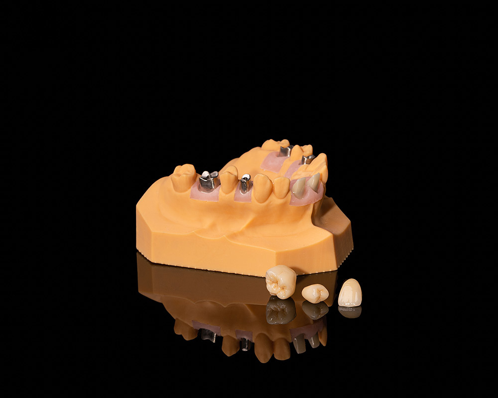 Custom Titanium Abutment Custom Titanium Abutment