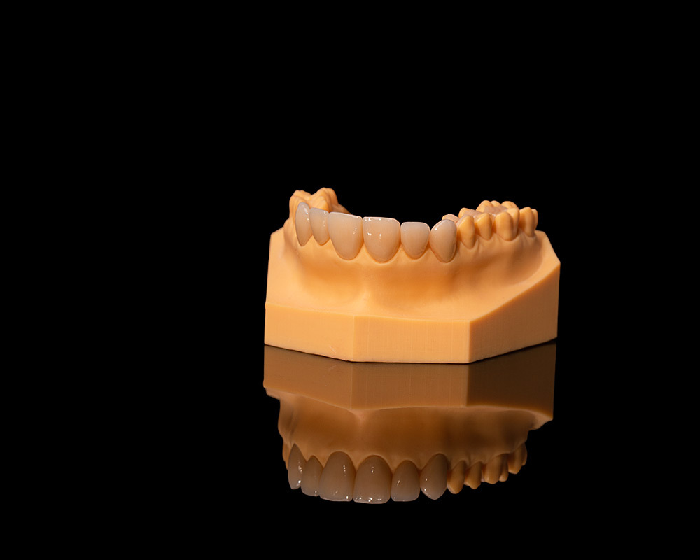 Emax Crown Emax Crown
