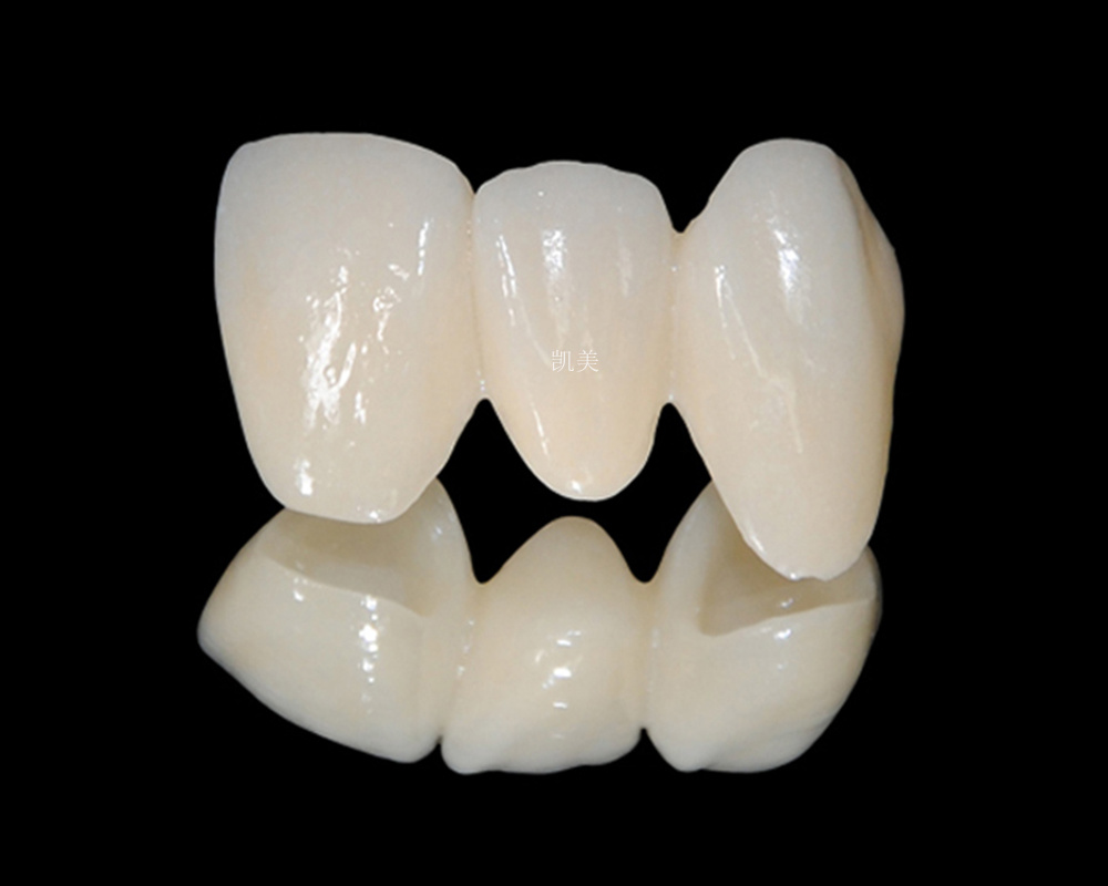 Ziroconia all-ceramic crown Ziroconia all-ceramic crown