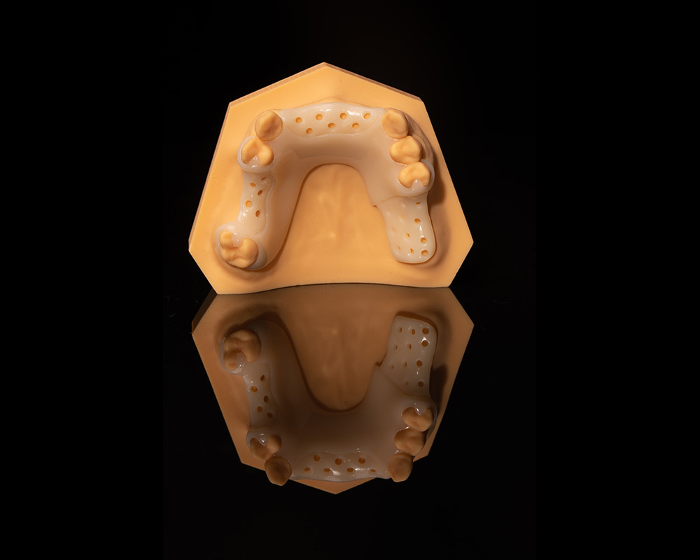 Tooth-Color Framework Tooth-Color Framework