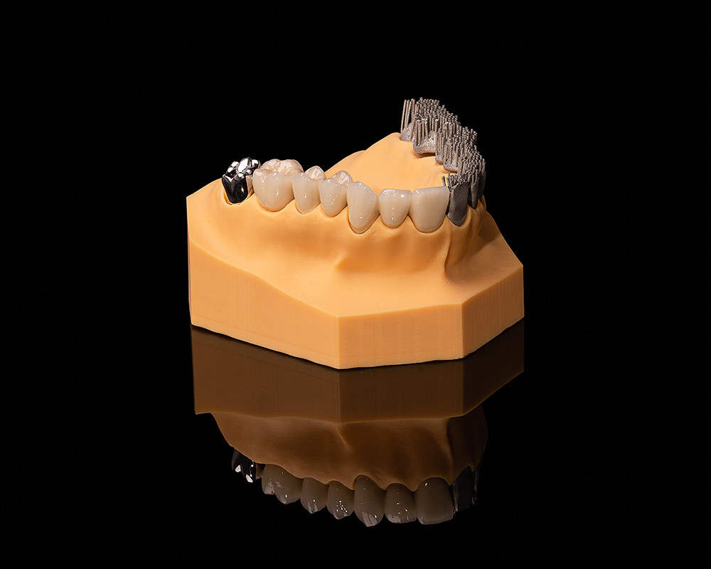 PFM(3D Printing) PFM(3D Printing)