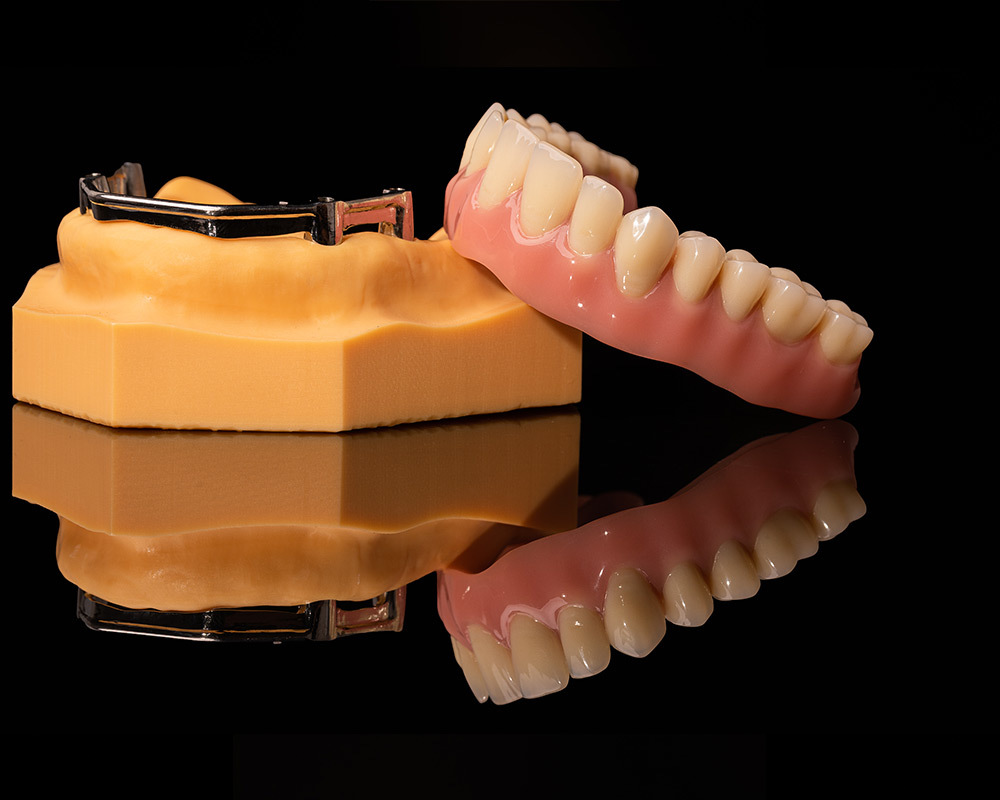 Implant Bar Implant Bar
