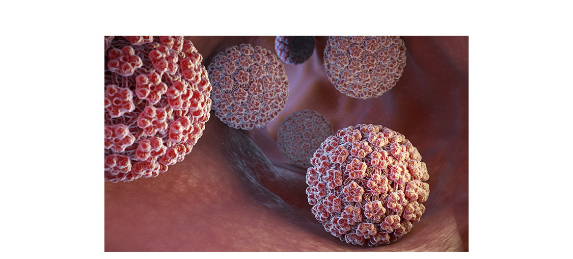 HPV感染与生殖健康