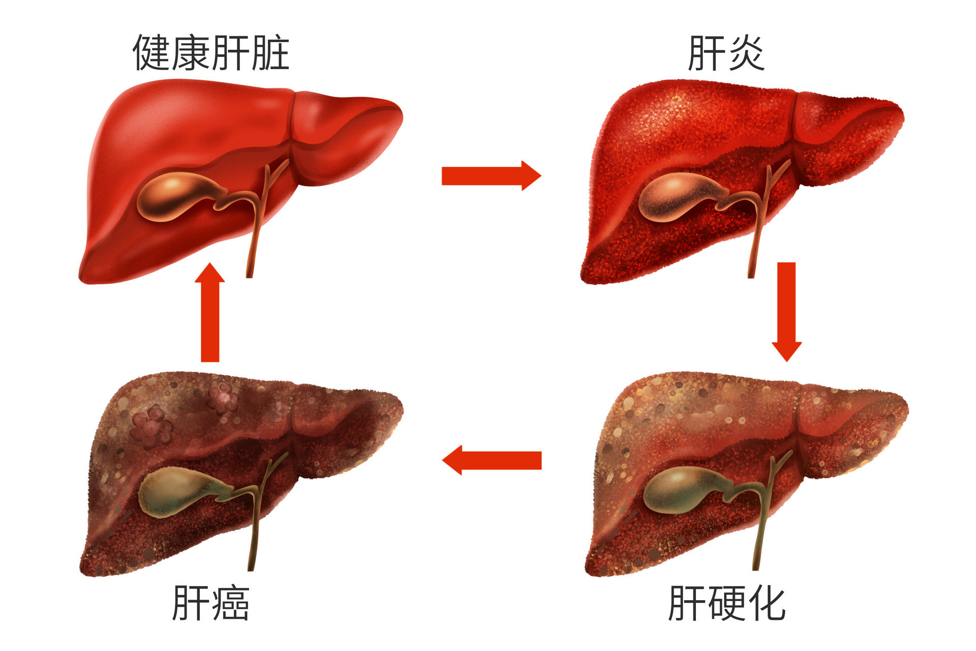 肝炎檢測(cè)